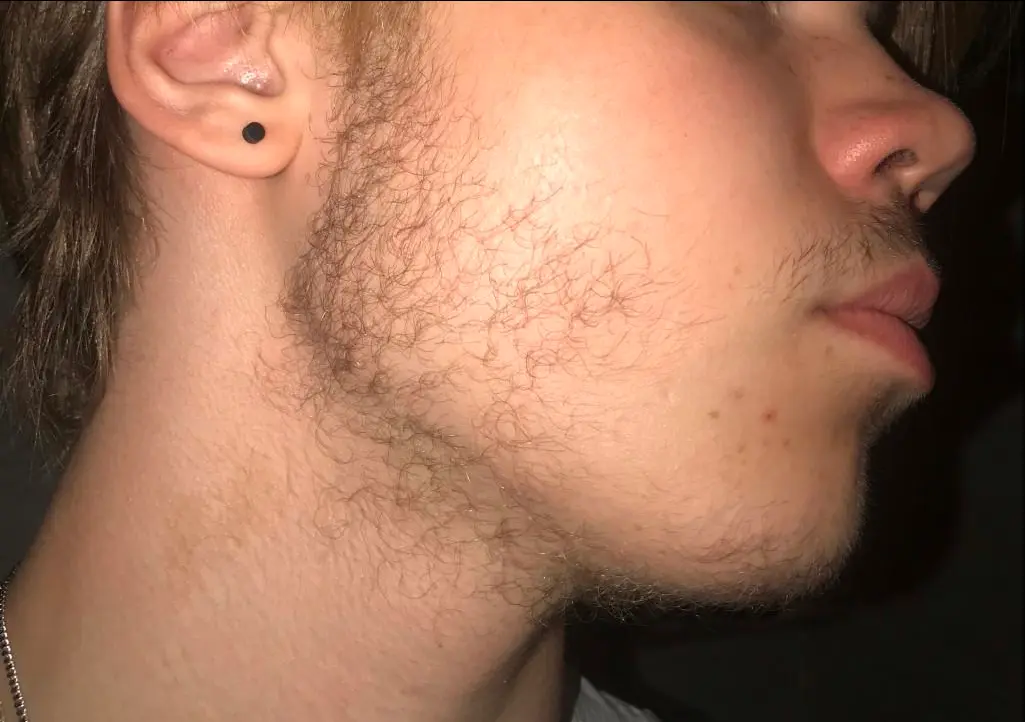 Age