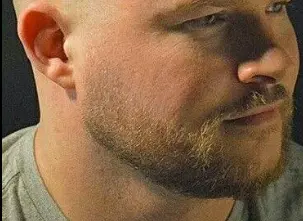 Circle Beard