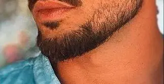 Patchy Growth