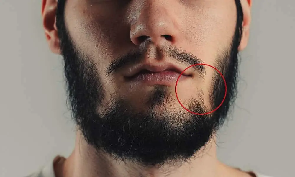 Thinning or Sparse Areas That Don't Fill In