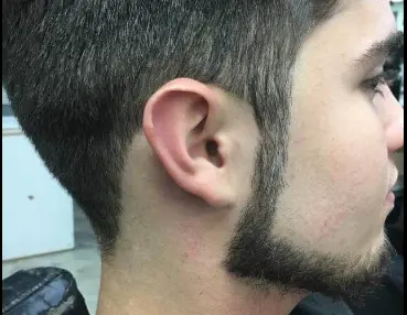  Chin Strap
