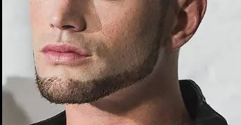 Chin Strap With Light Cheek Fill