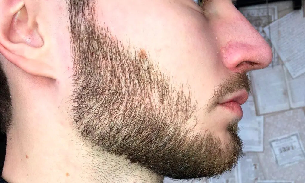 Patchy Growth