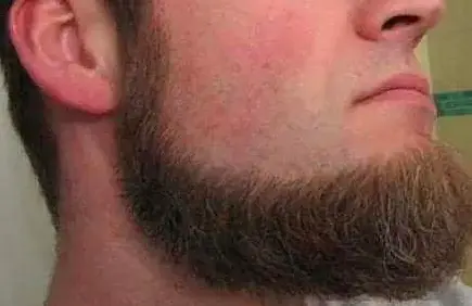 Thick, Coarse Hair