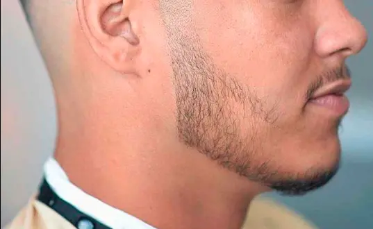 Burst Fade with Stubble